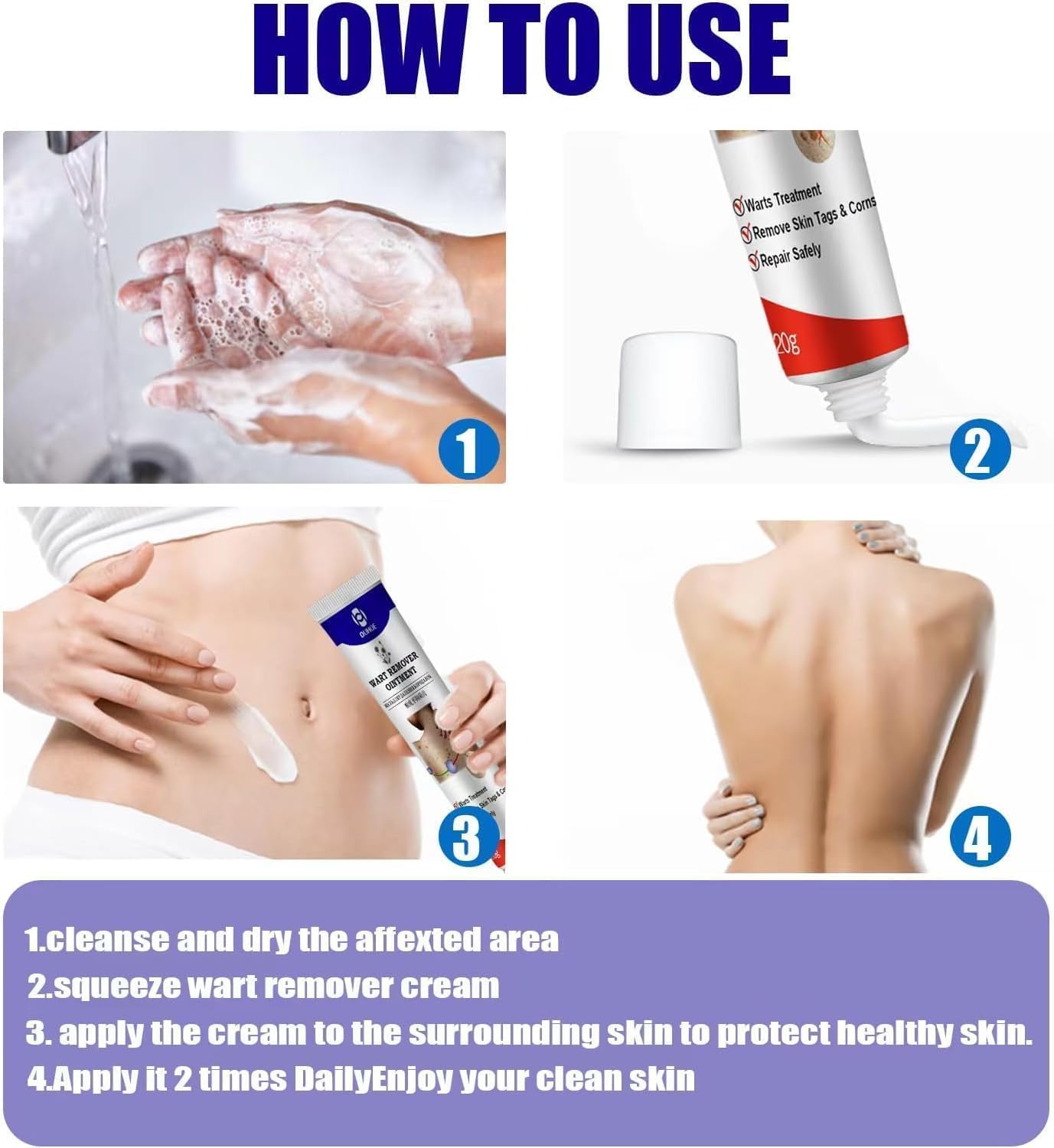 Warts Remover ointment