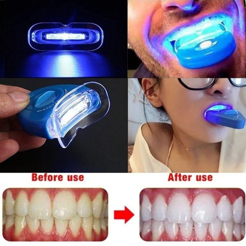 Tooth lightening device